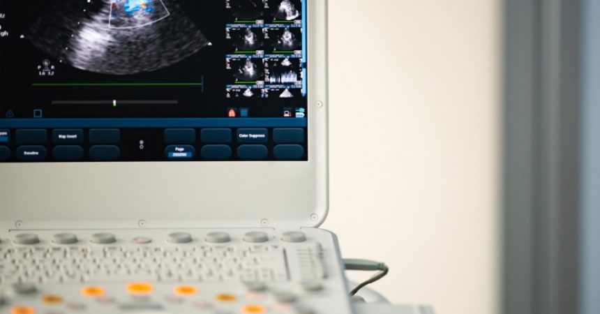 The Benefits of a Portable Ultrasound Machine For Your Clinic