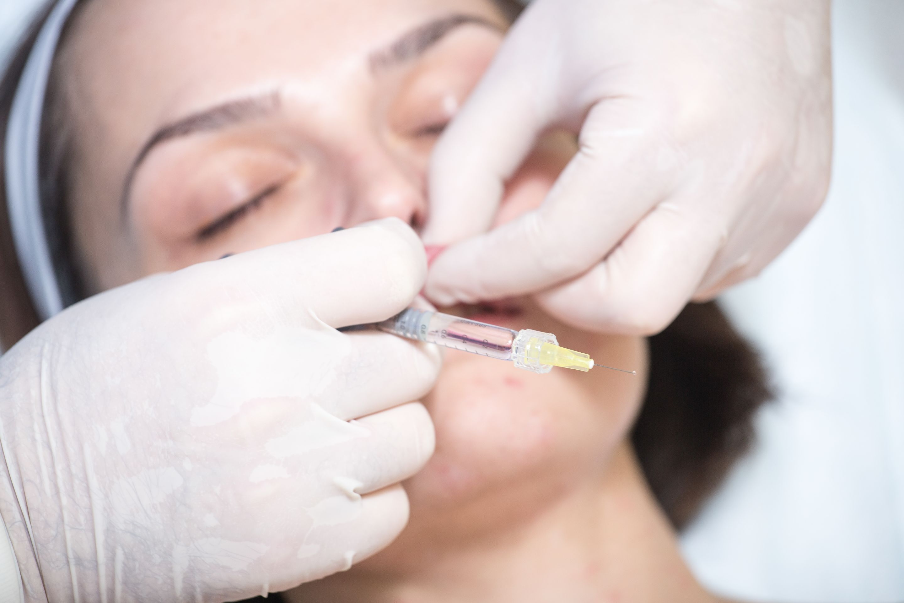 Exploring the Benefits of Online Microneedling Certification Programs