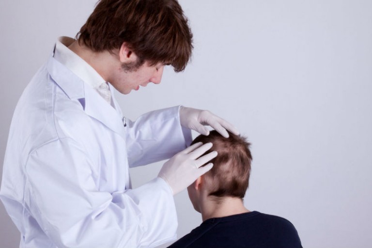 Determining Your Candidacy For Hair Transplants in McLean, VA