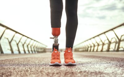 Investing in Your Mobility: Prosthetics in Metro Detroit, MI, Offer Long-Term Solutions for Limb Loss