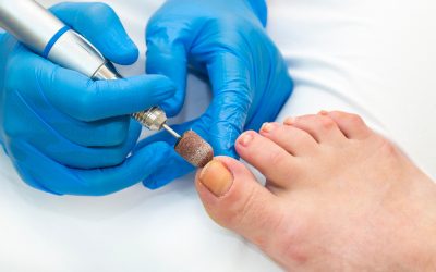 Proven Methods of Toenail Fungus Treatment in Jacksonville, FL, for Reclaiming Confidence and Optimal Foot Care